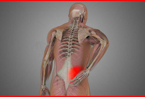 lumbar muscle strain