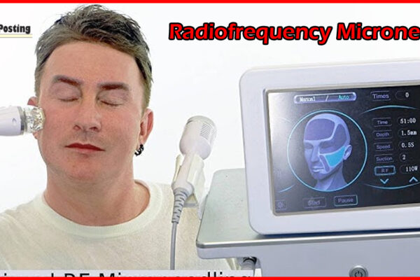 radiofrequency microneedle