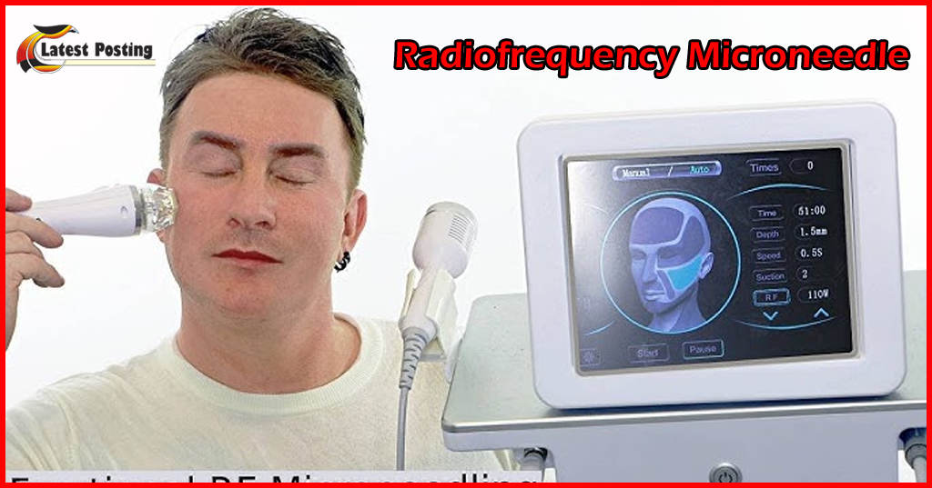 radiofrequency microneedle