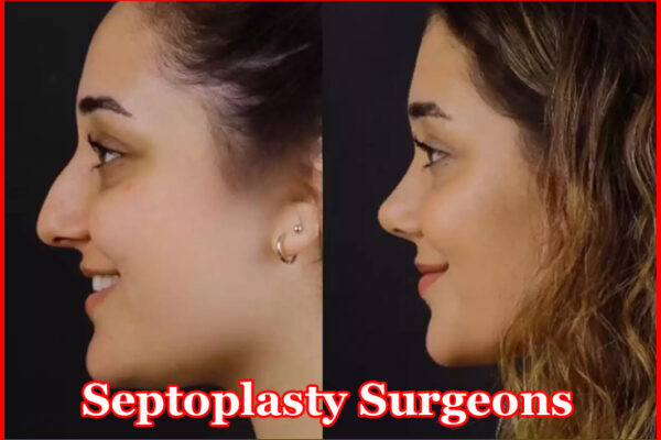 Septoplasty Surgeons