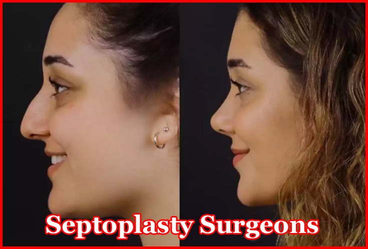 Septoplasty Surgeons